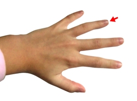 ringfinger1